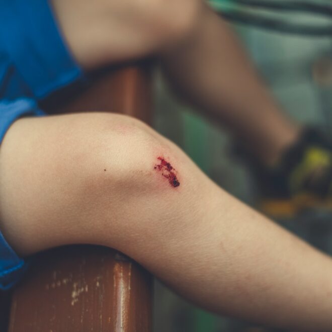 Revalideren na een kruisbandblessure: wat kun je verwachten