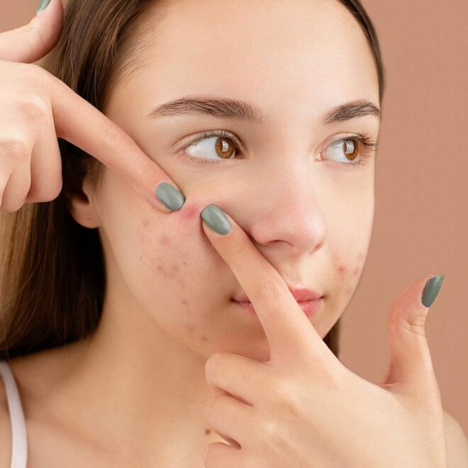 Het verwijderen van pigmentvlekken en het behandelen van melasma