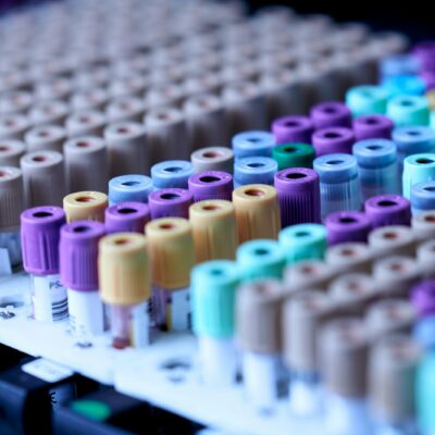 Bloedbuisjes voor bloedonderzoek in een laboratorium