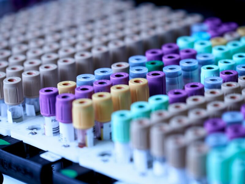 Bloedbuisjes voor bloedonderzoek in een laboratorium